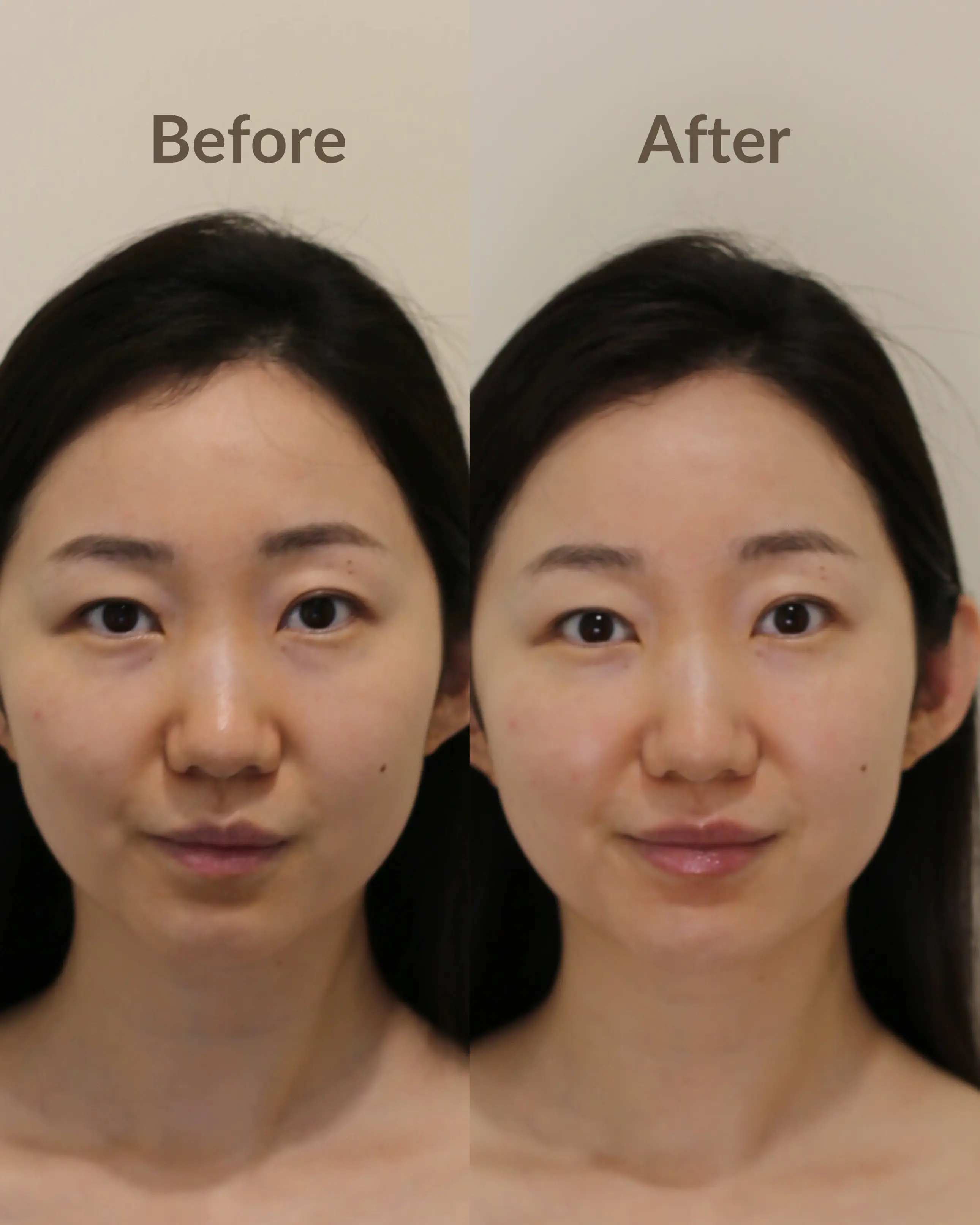 Dawn Break Moi-starter™ | Collagen Serum + Moisturiser + Primer - Ms Morning