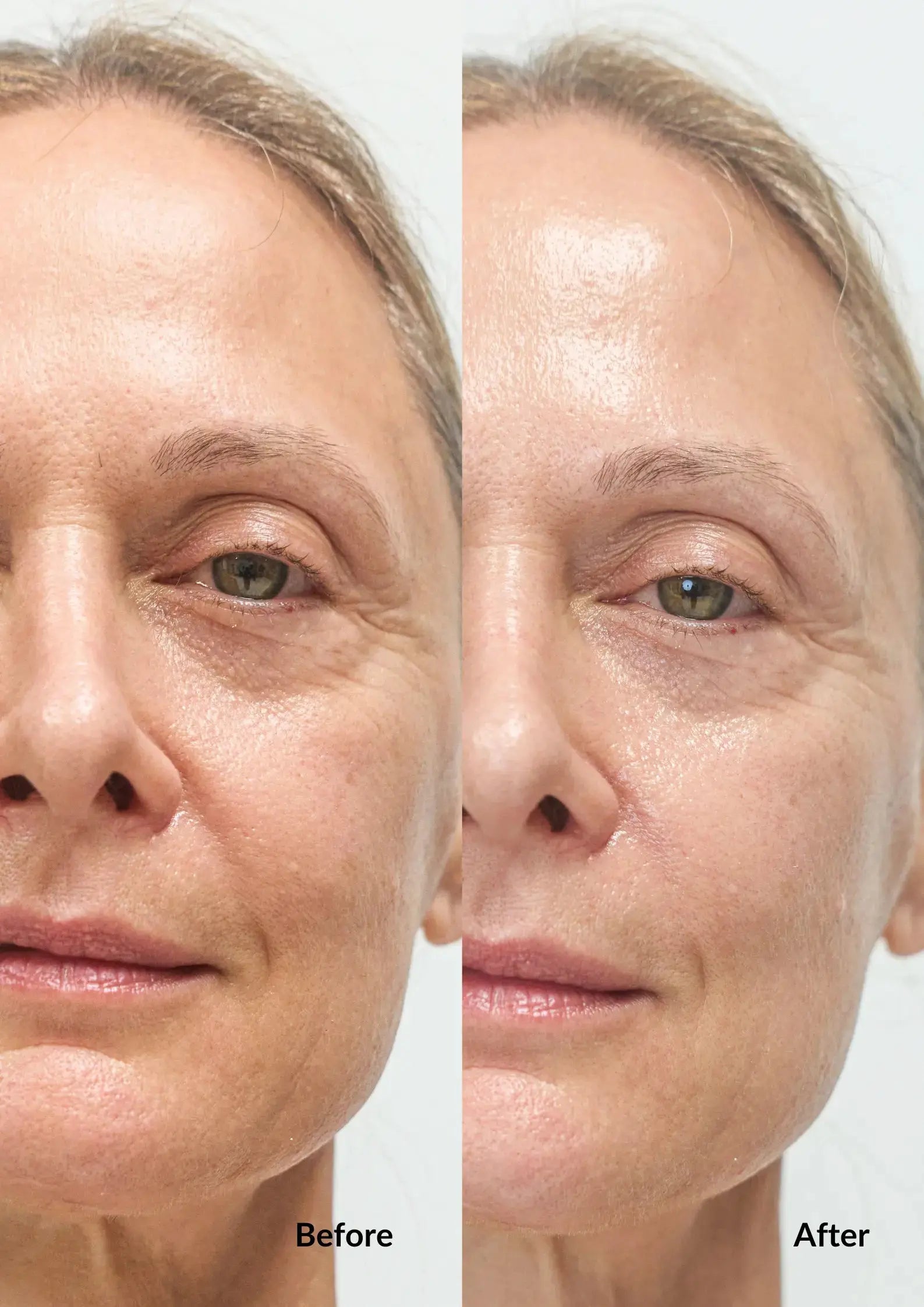 Bounce Back Sheet Mask - Ms Morning