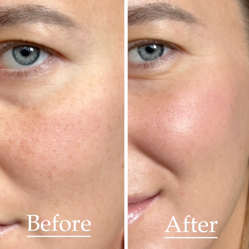 Dawn Break Moi-starter™ | All-In-One Face Base